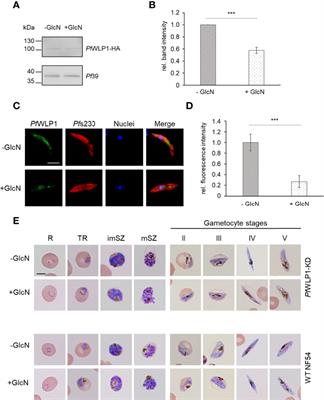 The WD40-Protein PfWLP1 Ensures Stability of the PfCCp-Based Adhesion Protein Complex in Plasmodium falciparum Gametocytes